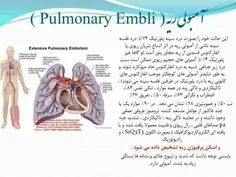 بخون مهمه