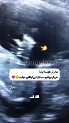 کوک تو واقعا اینجوری بودی؟😂