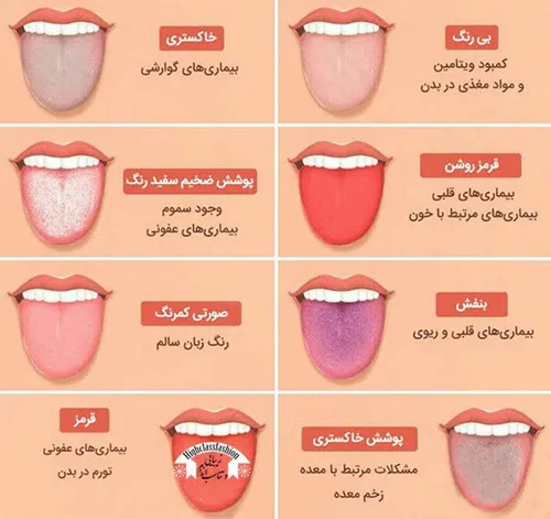 سلامت و تندرستی sammon 27543484 - عکس ویسگون