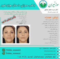 #طب #طب_سوزنی #طب_سوزنی #طب_سوزنی #طب_سوزنی_لاغری #لاغری 