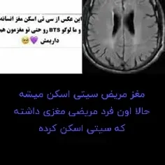 مغز مریض