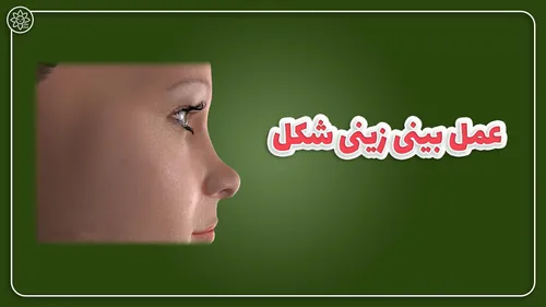 ترمیم و اصلاح عمل بینی زینی شکل