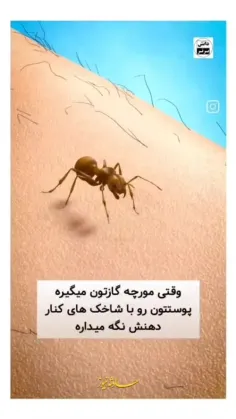 این ویدئو نحوهٔ گزش مورچه رو به شما نشون میده🐜