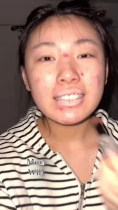 اصکی با اجازه