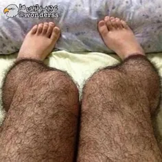 در سال 2013، ساپورتهای مدل موهای پای مردانه! در چین به مُ