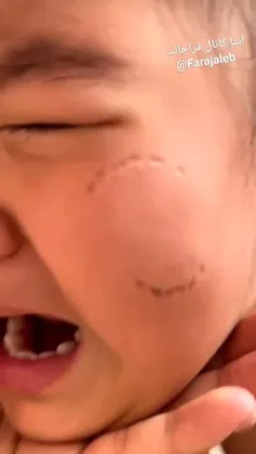 کنترل خشم صفر 😅😅😅😅
