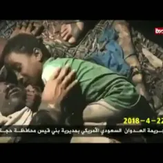 🎥طفل یمنی از آغوش پدر شهیدش زیر آوار جدا نمی شود. سبحان ا