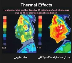 حرارت ایجاد شده روی صورت بعد از ۱۵ دقیقه مکالمه با تلفن ه