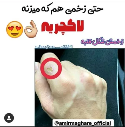 مگا استار زخمایی هم که میزنه لاکچریه