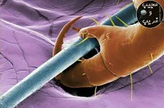 تصویر میکروسکوپیک از یک تار مو در چنگال شپش سر بالغ