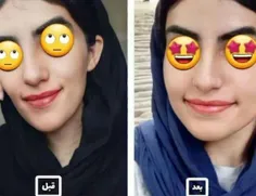 *از لاغری صورتت خسته شدی؟ 😟 از عوارض بوتاکس می ترسی؟ 😱 دن