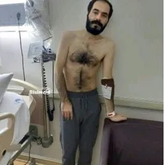 عکس جدید از حسین رونقی میبینید که هم دوتا پاهاش شکسته همر