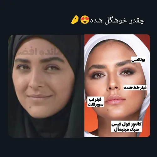 لاناتی جذاب🤣😍