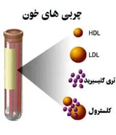 **چند روش برای کاهش چربی خون **
