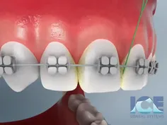 بهداشت دهان و دندان 