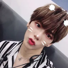 VERIVERY’s Minchan Suffers Minor Head Injury