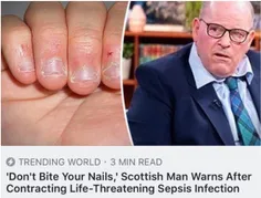 ناخناتونو نجویید ! این آقا تو اسکاتلند عادت داشته ناخناشو