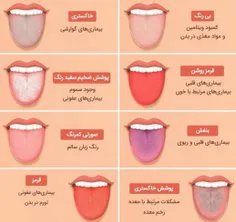 تشخیص بیماریها از روی رنگ زبان