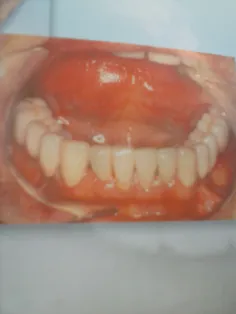 روزانه یک بار شده نخ دندان ف...