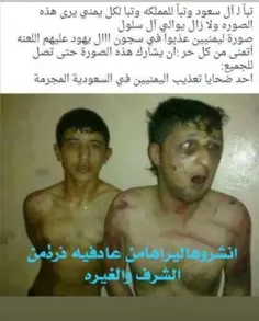 شکنجه های زندانیان بیگناه یمنی در زندان های آل سعود... 