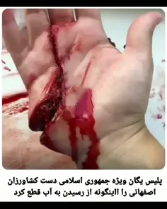 پاره کردن فجیع دست کشاورزان توسط یگان ویژه حکومت ایران!!!