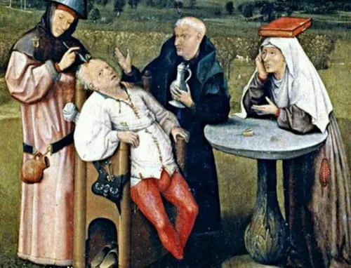 در دوران باستان بعضی از پزشکان سر بیمار را سوراخ می کردند