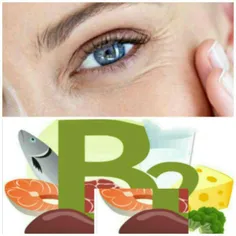 علت چروکهای دور چشم کمبود ویتامین B2 ست،که روی سلامت چشم 