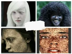عجیب ترین و نادرترین رنگ پوست ها در جهان