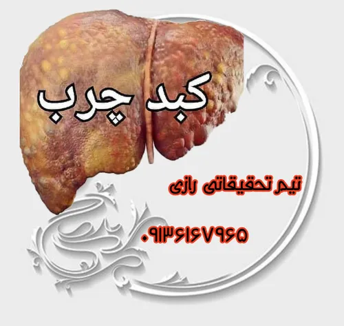 کبد چرب 💎 علائمی هشدار دهنده که به شما می گویند مبتلا به 