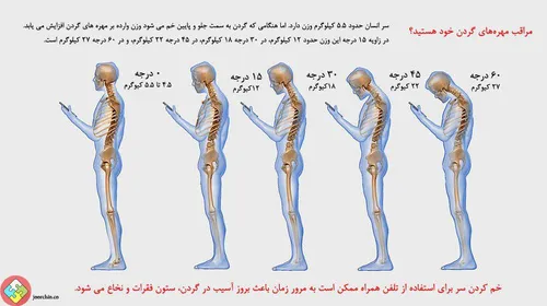 آسیب موبایل به ستون فقرات . . .