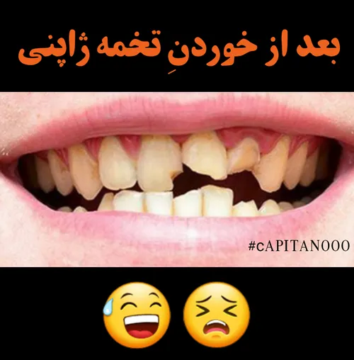 سلام دوصتان 😅 🖐