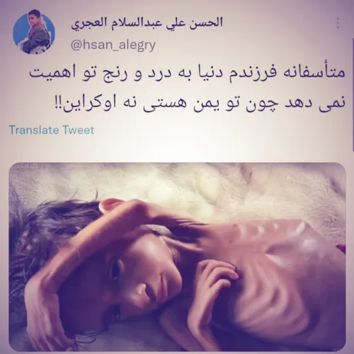 توئیت یک یمنی نسبت به حقوق بشر دروغین