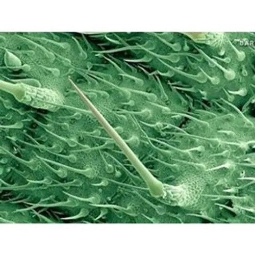 تصویر میکروسکوپی از برگ گزنه