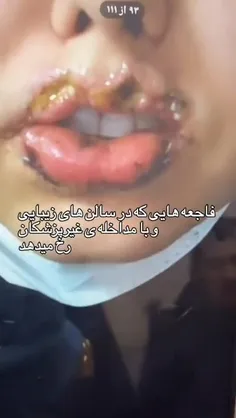 فاجعه هایی که تو سالن های آرایشی رخ میده😐🤦‍♂️