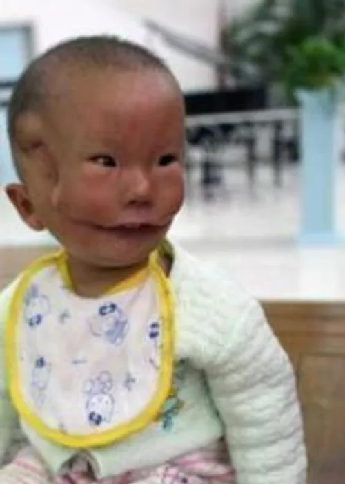 کودکی در چین که به دلیل نقص مادرزادی لقب عجیبی از سوی مرد