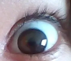 اینم چشم من یهویی