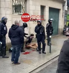 🔴 ‏پلیس‌های مهربون فرانسه در حال کمک به یک معترضی که خون‌