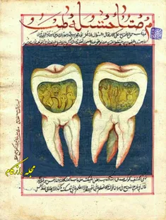برگی از کتاب#دندانپزشکی نوشته شده در ۲۰۰ سال پیش در استان