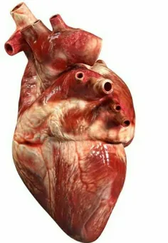 "قلب موقت"مجوز تولید گرفت بیماری‌ها و عوارض قلبی از شایع‌