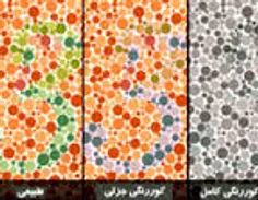 چشم (5) : تشخیص کور رنگی و درمان آن 