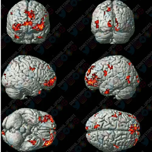 پزشکان با استفاده از اسکن مغز یک انسان عاشق دریافتند هنگا