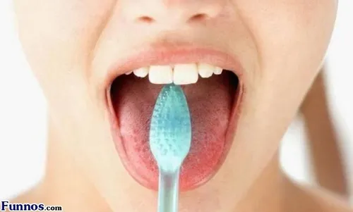 بی توجهی به تمیز کردن زبان باعث این بیماری ها می شود