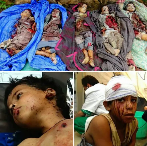 جنایت جدید سعودی ها در یمن؛ کشته و زخمی شدن حداقل20 دانش 
