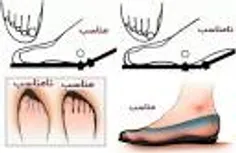 چرا پوشیدن کفش مناسب در فصول گرم مهمتر از فصول سرد است ؟