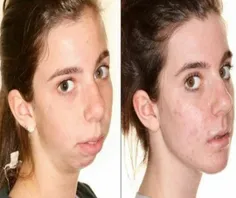 تغییر چهره بیمار پس از جراحی فک و صورت!
