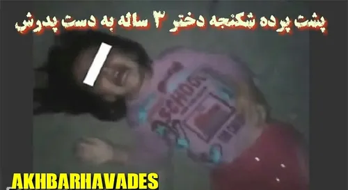 پشت پرده شکنجه دختر ۳ ساله به دست پدرش