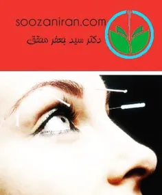 درمان سینوزیت با طب سوزنی