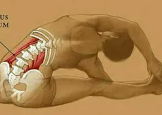 این ماهیچه ای است که باعث ایجاد کمردرد میشود 