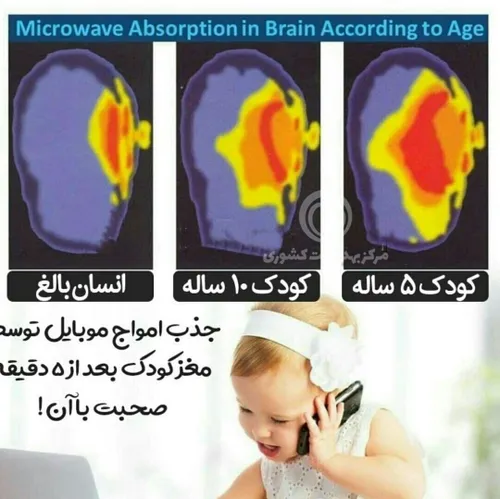 جذب امواج موبایل توسط مغز کودک بعد از ۵ دقیقه صحبت با آن!