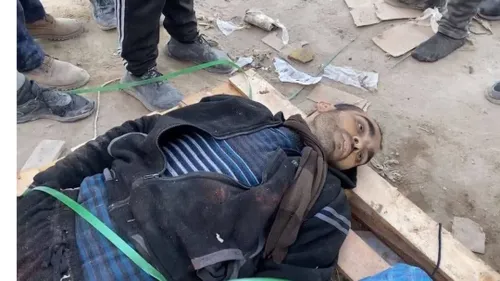 🔴 ۸۵۰ شهید و زخمی؛ نتیجه جنایت جدید صهیونیست ها در غزه
